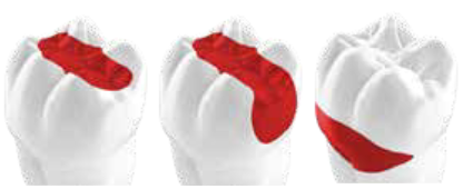 Screenshot 2022-12-21 at 07-09-40 EQUIA_Forte_HT_Brochure.pdf